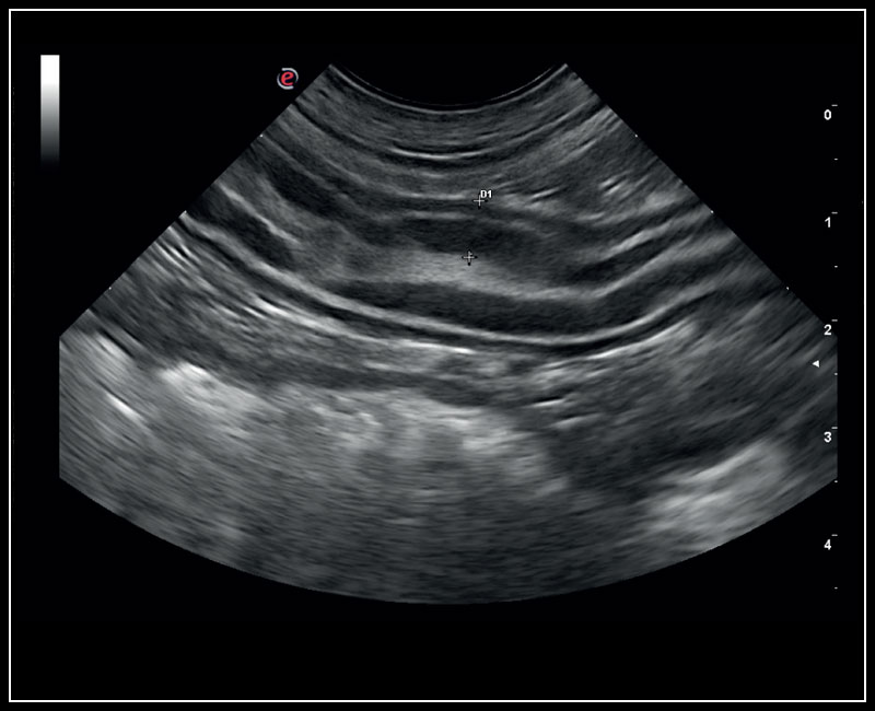 Esaote MyLab™X5VET — Ecógrafo Veterinario Versátil miniatura 3