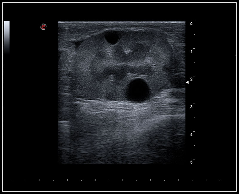Esaote MyLab™X5VET — Ecógrafo Veterinario Versátil miniatura 4